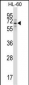 TRIM23 Antibody (N-term)